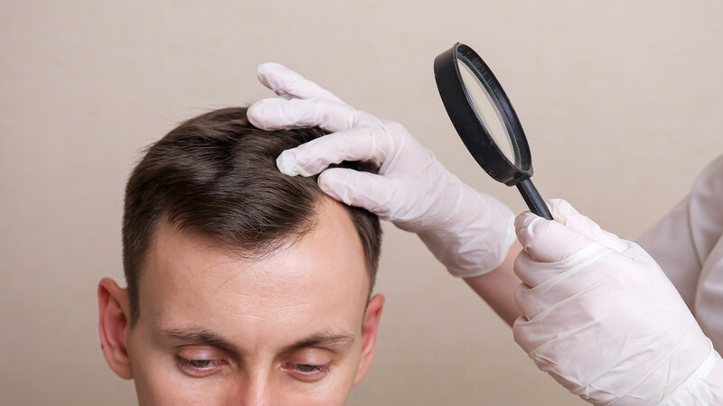 Корки на голове ᐉ диагностика, лечение в МЦ 